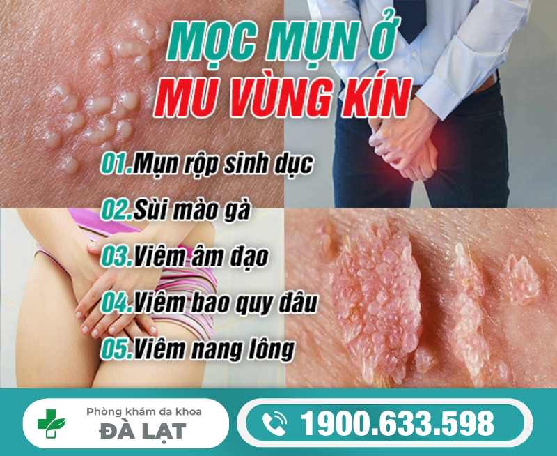 Hình ảnh minh họa